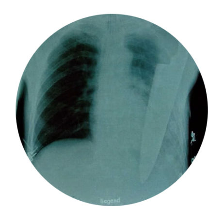 Study for the NBME Surgery Shelf Exam