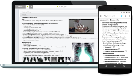amboss-auf-laptop-und-tablet